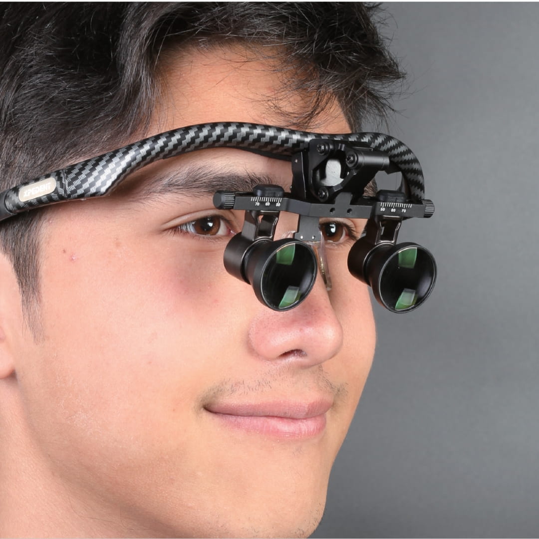 XPEDENT CarbonFore Galilean Dental Loupes