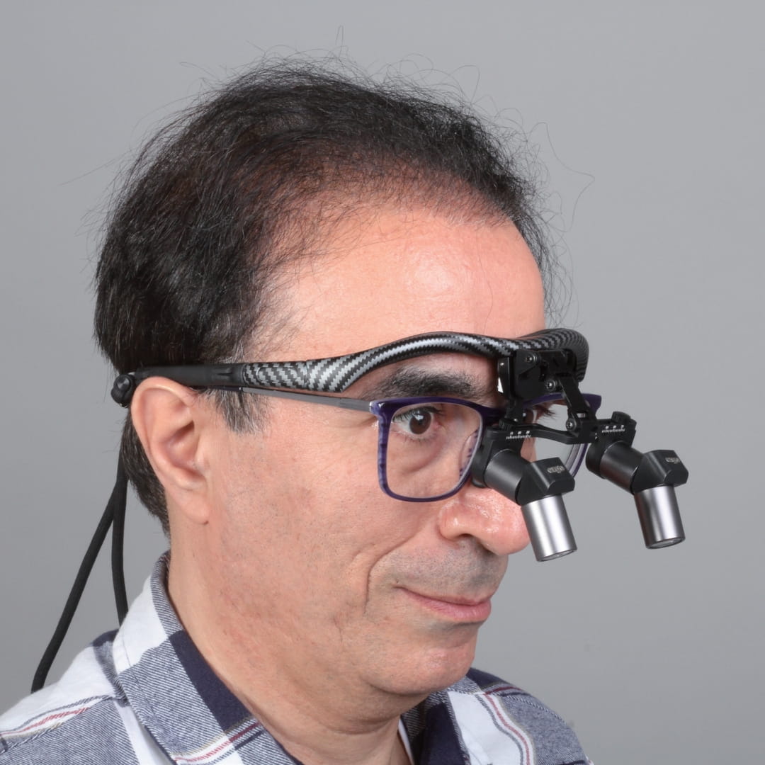 XPEDENT CarbonFore Ergo Dental Loupes