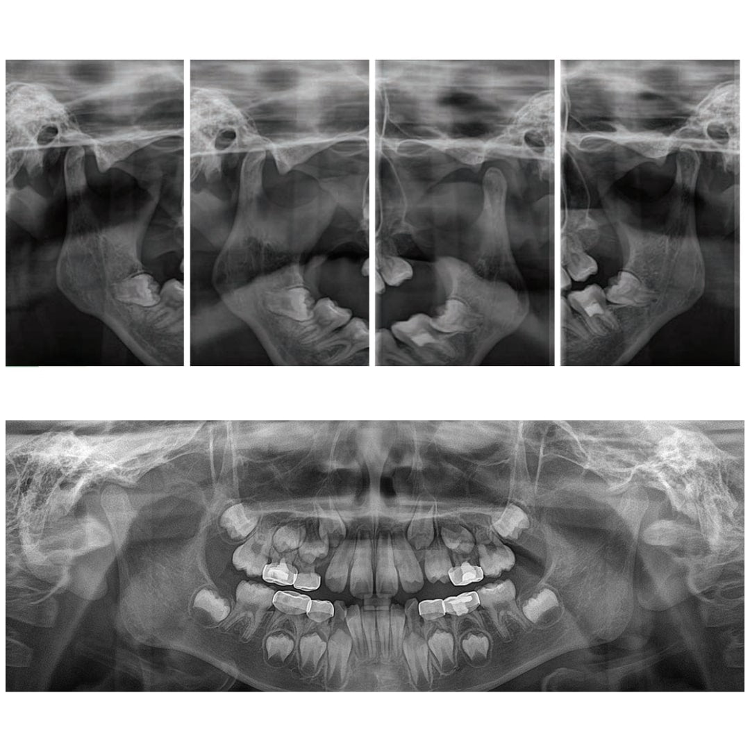 Genoray Papaya – 2D Panoramic Dental X-Ray System