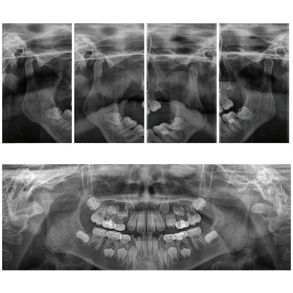 Genoray Papaya – 2D Panoramic Dental X-Ray System