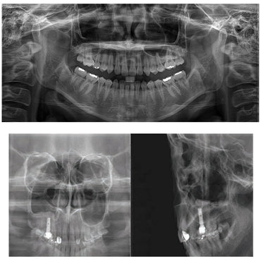 Genoray Papaya – 2D Panoramic Dental X-Ray System